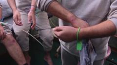 Three of the men show the bruises on their wrists and legs