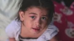 A young girl with a bruised face looks into the camera