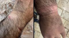 Filistinli aktivist Issa Amro BBC'ye yaptığı açıklamada, 7 Ekim'de IDF tarafından gözaltına alındığında ellerinin sıkı bağlandığını ve bunun kan dolaşımını kestiğini söyledi