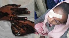 Collage of file foto of pesin wit henna hand and di bride face wey show her damaged eye