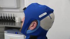 Brain-cooling treatment for concussion trialled
