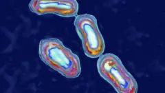 Getty Images Plague bacterium