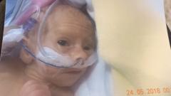 Premature Baby's First Christmas: 'I Didn't Think She'd Survive' - BBC News