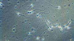 Espermatozoides sob microscópio