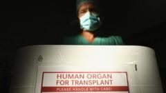 transplansi organ manusia