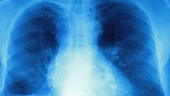 Access to cystic fibrosis drugs approved in England