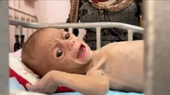 A malnourished, frightened baby with enormous eyes stares at the camera and cries.