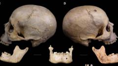 Le crâne vieux de 4 000 ans qui révèle comment les Égyptiens tentaient d'opérer le cancer