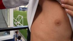 V Christ'ın kaburgaları arasına giren kurşunun izi