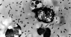 Yersinia pestis бактериясы (же чума таякчасы)