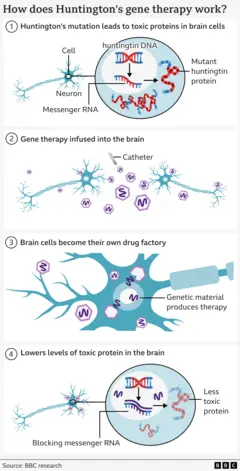 Graphical illustration of how the therapy works separated into four tiles. The first shows a spindly brain cell with a zoomed-in section showing a DNA double helix in blue with a red section denoting the mutated DNA and the build up of toxic protein, also red, inside the brain cell. Tile 2 shows two neurons and hexagonal viruses with a purple line in the middle. Tile 3 shows a close-up of the neurons from before with the viruses inside and releasing their purple squiggly line. Tile 4 goes back to the same zoomed-in view of a neuron, but this time the purple squiggles are sticking to the previous genetic code so there is less toxic protein being made, represented by it being shaded out.
