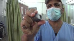 Médico mostra munição que expodiu hospital