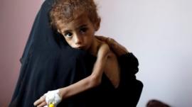 El informe de la ONU que acusa a EE.UU., Francia y Reino Unido de ser cómplices de posibles crímenes de guerra en Yemen