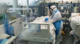 فيروس كورونا: ممرضة مهمتها وقف أجهزة التنفس الصناعي ليتوقف قلب المريض _111807278_whatsubject