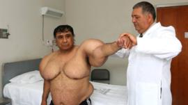 Willy en el hospital, siendo revisado por el médico