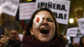 Por qué tantos manifestantes alrededor del mundo están sufriendo lesiones en los ojos