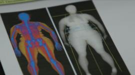 DEXA scan results show body fat
