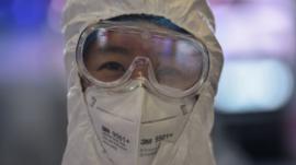 5 cosas que podemos aprender del brote de coronavirus en China a medida que se esparce por el resto del mundo