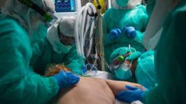 Equipe médica usando equipamentos de proteção individual coloca paciente de bruços em leito de uti