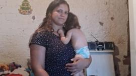 'Não tem comida em casa': o drama das mães de crianças vítimas do zika na fila do INSS