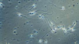 A surpreendente forma como os espermatozoides realmente nadam