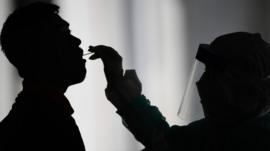 لماذا يصعب على دول العالم توفير اختبارات الكشف عن كورونا؟