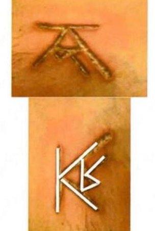 KR branded on to skin