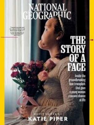 Imagem mostra capa da edição de setembro da revista National Geographic, mostrando foto de Katie Stubblefield. Ela é a mais jovem americana a passar por um transplante facial. Foi submetida à cirurgia após uma tentativa de suicídio que a fez perder grande parte do rosto.