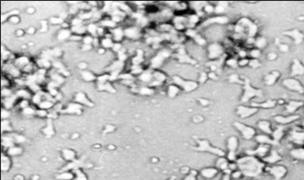CÃ©lulas do sistema imune (linfÃ³citos), que infiltram o tecido da vÃ¡lvula do coraÃ§Ã£o