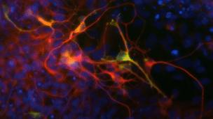 Dopamine neurons generated from human stem cells