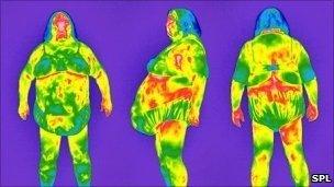 Thermograms of an obese woman. Pic Tony McConnell/SPL