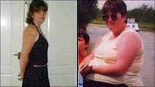 Hazel Kent before her gastric band was fitted (right) and after