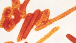 Ebola virus seen through a microscope
