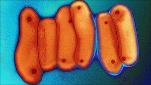 A coloured micrograph of a cross-section of the tuberculosis bacteria