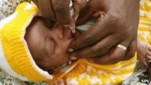 Child receiving polio vaccine