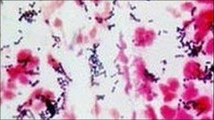 Image of streptococcus