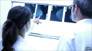 doctors looking at an x-ray of a breast