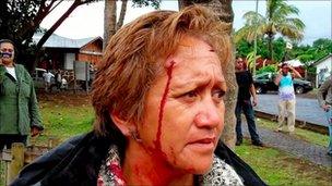 An resident of Easter Island with a pellet gun wound to her head (4 Dec 2010)