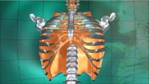 A thorax in 3D