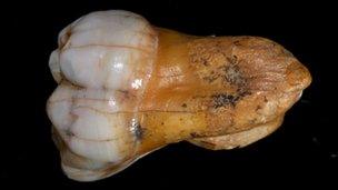 Denisovan tooth