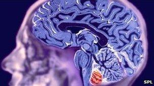 MRI scan of healthy brain