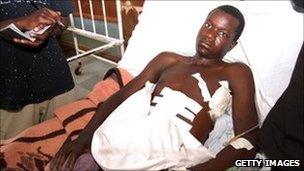 Wounded miner Vincent Chenjela (file picture, Oct 2010)