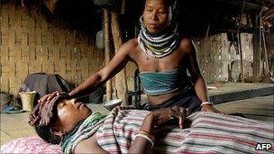 Malaria sufferer in India (file image)