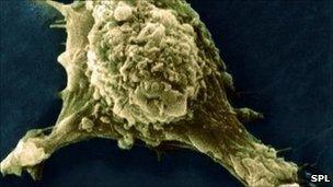 Мигрирующая раковая клетка