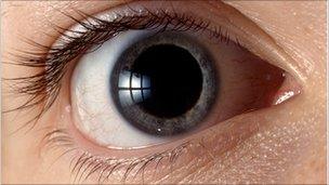 Eye