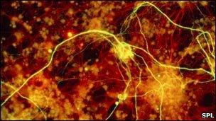 Nerve fibres in the brain