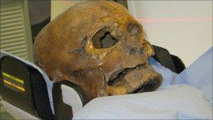 The skull of Simon Theobald