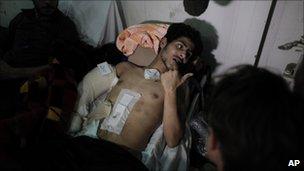 An injured man aboard the Turkish ship docked in Benghazi, 3 April