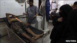 A protester injured in clashes on Saturday night in Sanaa is treated in hospital, 10 April