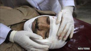 Injured suicide bomb victim in Pakistan (April 2011)